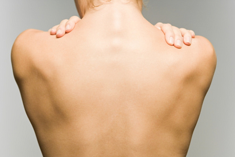 Waspadalah, Osteoporosis Juga Mengincar Wanita Muda!