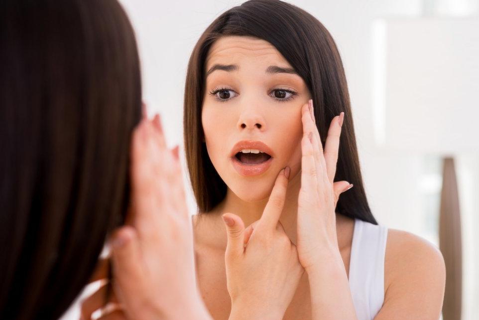 Kenali Penyebab dan Cara Mengatasi Cystic Acne!