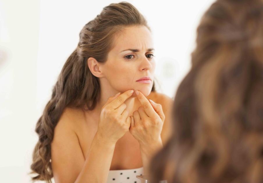 5 Kebiasaan Buruk Penyebab Jerawat!