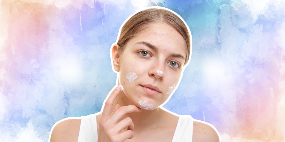 Gak Perlu Ribet! Ini Cara Alami Menghilangkan Bekas Jerawat