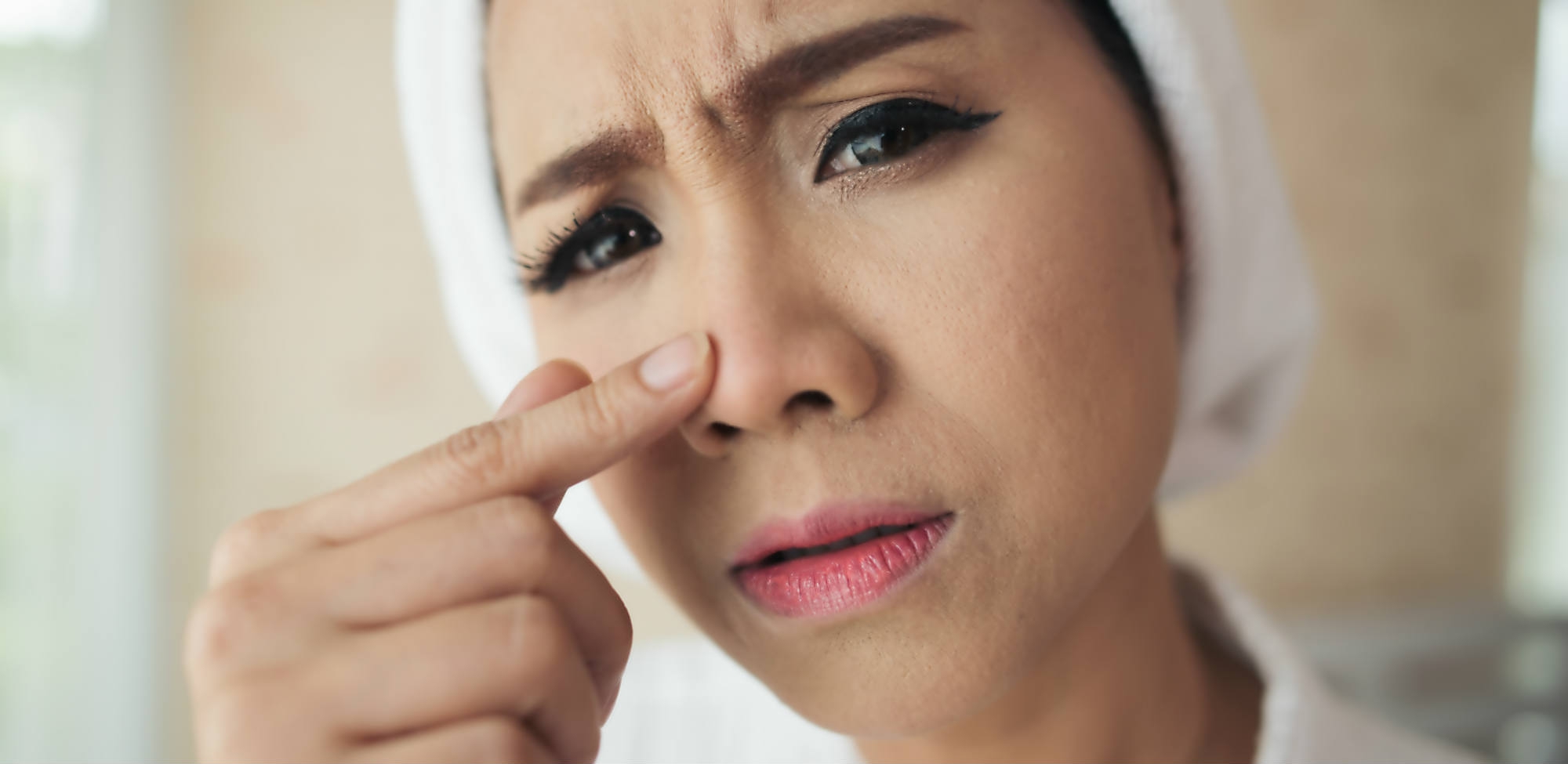 Cara Mengatasi Jerawat Batu Tanpa Perlu ke Dokter Kulit