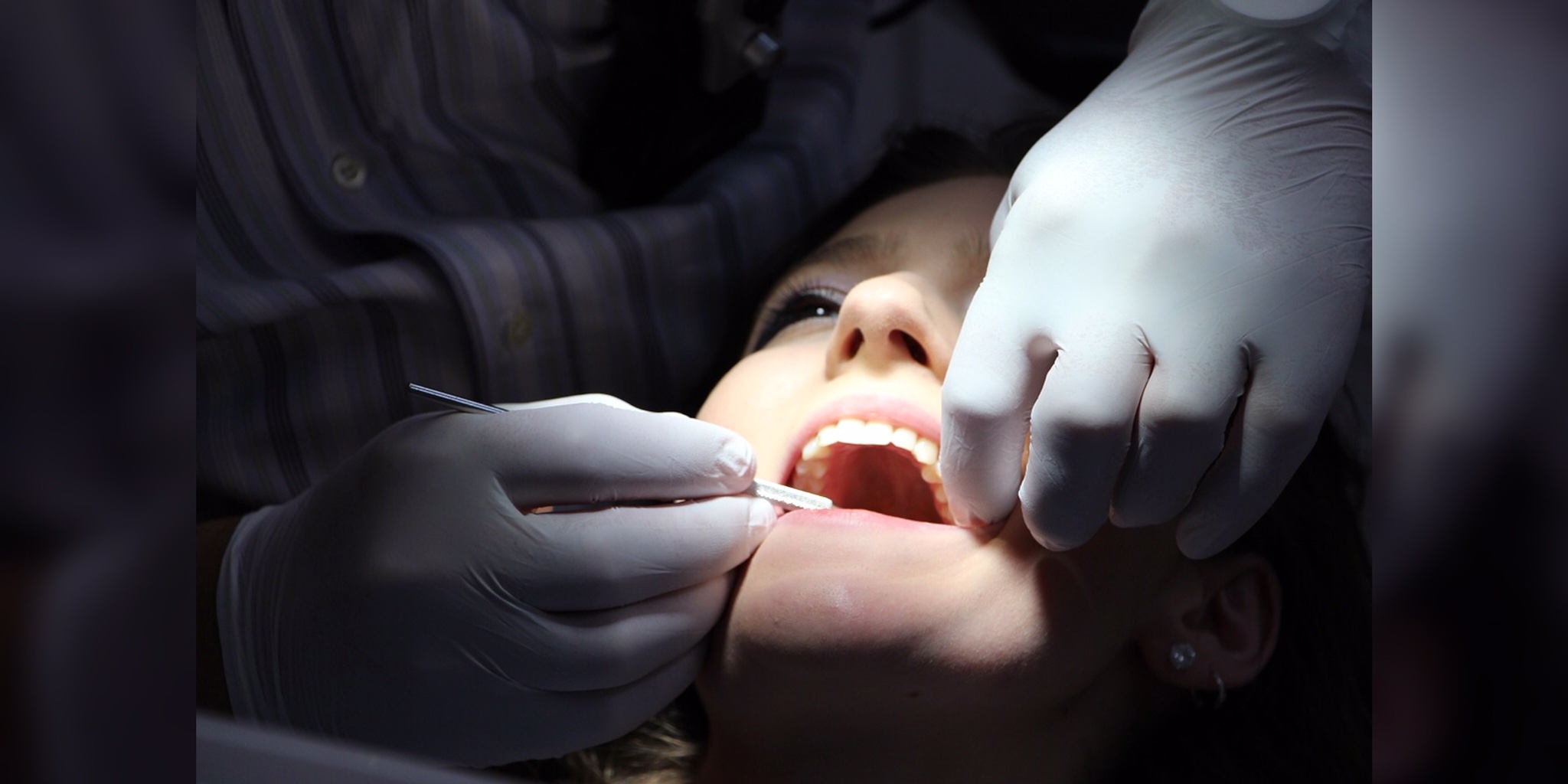 Ini Dia Jenis Kecantikan Gigi Yang Perlu Kamu Ketahui! 