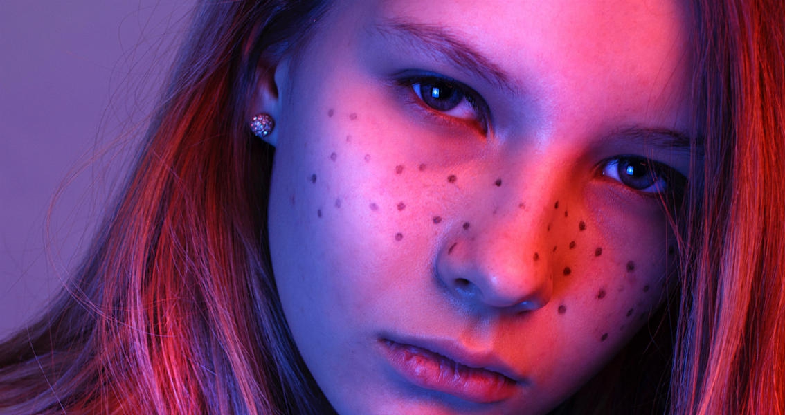 Di Usia Berapa Boleh Mencoba Laser Kulit?