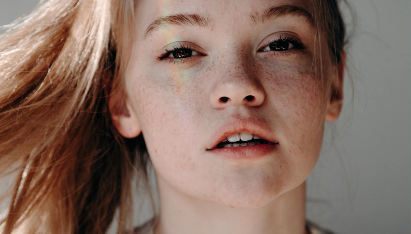 Cara Memudarkan Bekas Jerawat dan Meratakan Tekstur Kulit