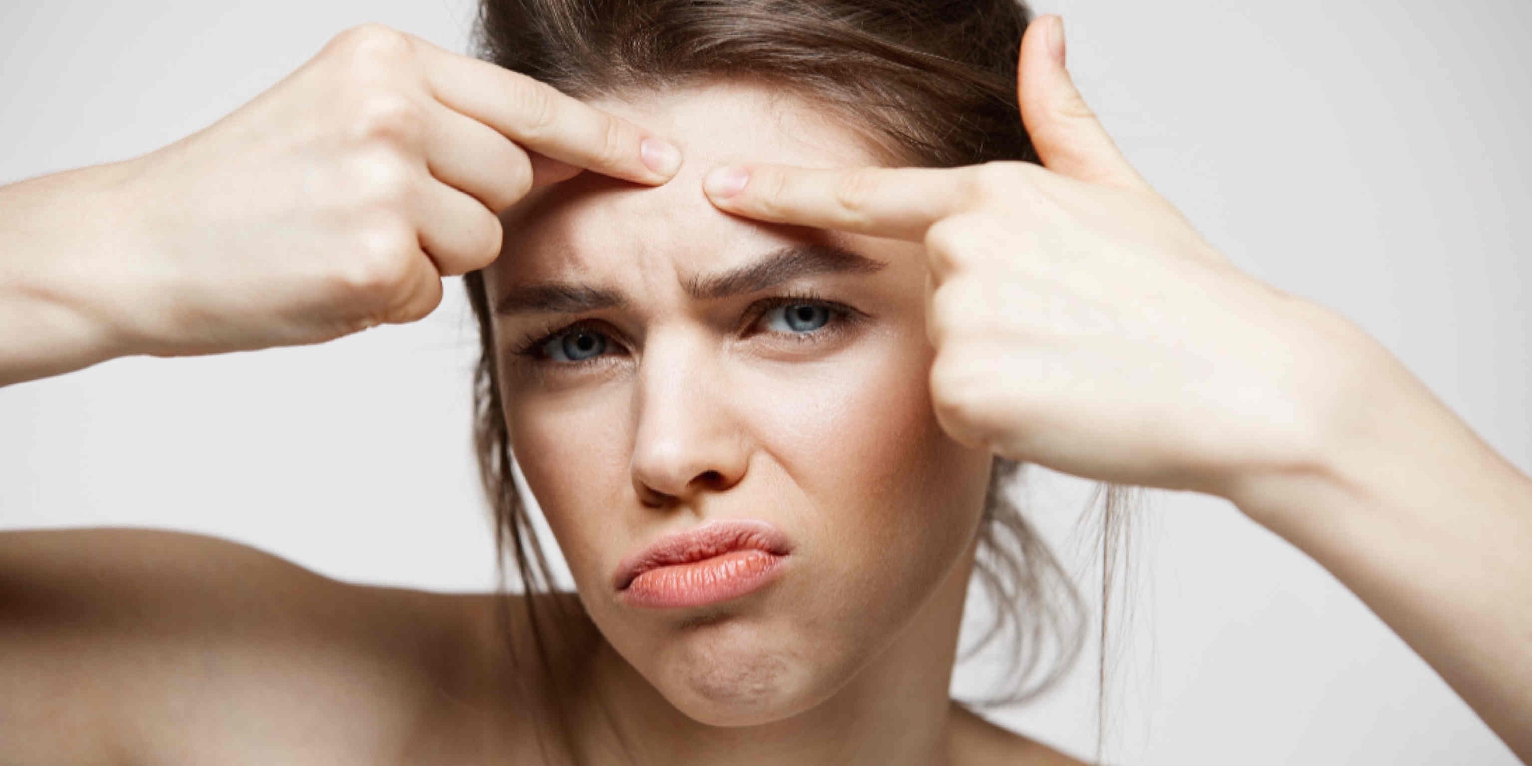 Cuaca Panas Bikin Kulit Jerawat? Atasi Dengan Cara Ini!