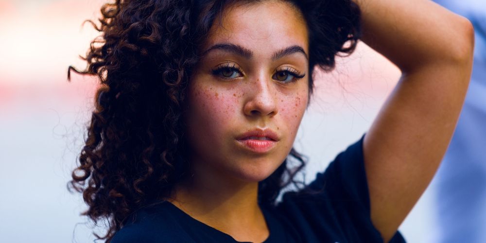 Inilah Tipe-Tipe Jerawat yang Perlu Kamu Ketahui!