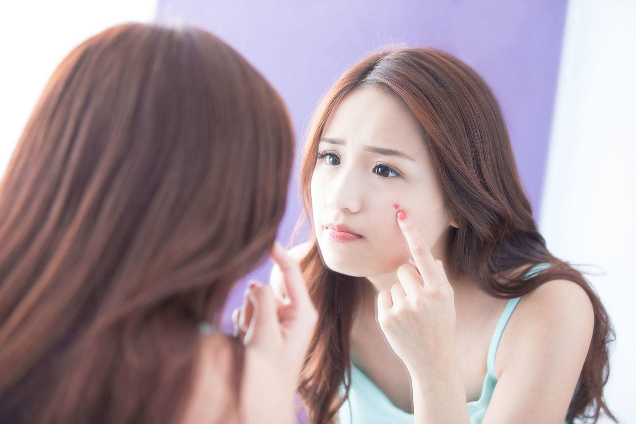 Melawan Jerawat dengan Tea Tree Oil