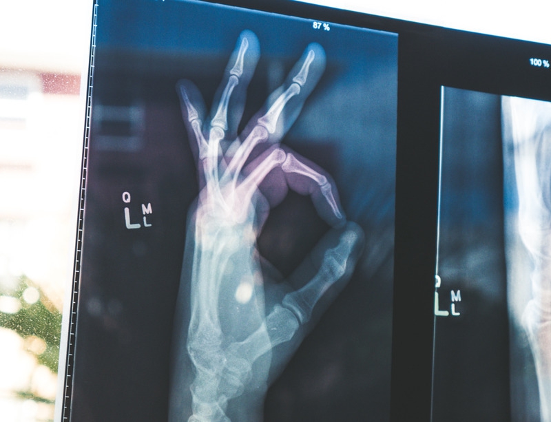 Ini 7 General Check Up yang Sebaiknya Perempuan Lakukan!