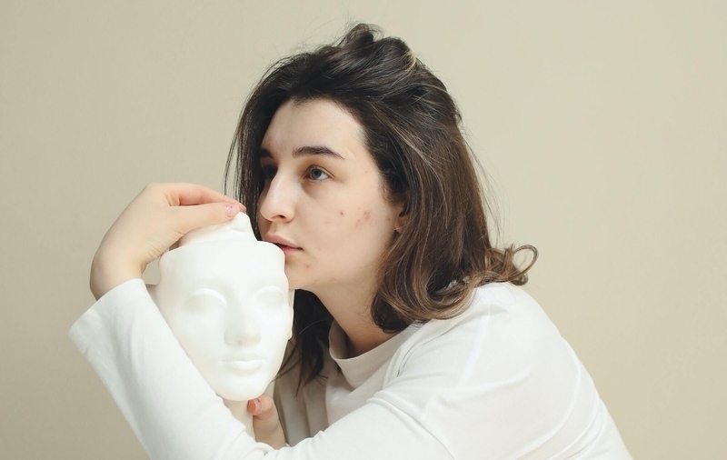 Stres & Frustasi Akibat Jerawat? Ini 6 Cara Menghadapinya!